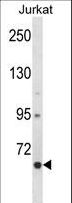 CRTC2 / TORC2 Antibody - CRTC2 Antibody western blot of Jurkat cell line lysates (35 ug/lane). The CRTC2 antibody detected the CRTC2 protein (arrow).