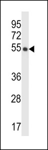 CRTR1 / TFCP2L1 Antibody - CRTRT1 Antibody western blot of human placenta tissue lysates (35 ug/lane). The CRTRT1 antibody detected the CRTRT1 protein (arrow).