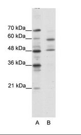 CRTR1 / TFCP2L1 Antibody - A: Marker, B: Jurkat Cell Lysate.  This image was taken for the unconjugated form of this product. Other forms have not been tested.