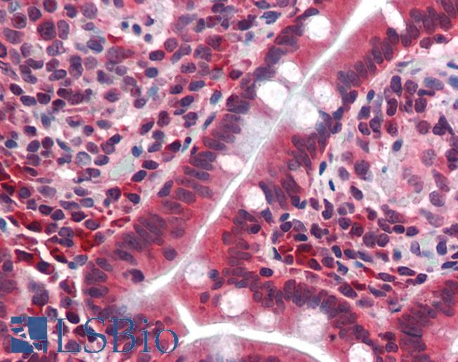 CRTR1 / TFCP2L1 Antibody - Anti-TFCP2L1 / CRTR1 antibody IHC of human small intestine. Immunohistochemistry of formalin-fixed, paraffin-embedded tissue after heat-induced antigen retrieval. Antibody concentration 5 ug/ml.  This image was taken for the unconjugated form of this product. Other forms have not been tested.
