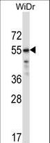 CRTR1 / TFCP2L1 Antibody - TFCP2L1 Antibody western blot of WiDr cell line lysates (35 ug/lane). The TFCP2L1 antibody detected the TFCP2L1 protein (arrow).