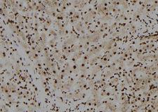 CRTR1 / TFCP2L1 Antibody - 1:100 staining human liver tissue by IHC-P. The sample was formaldehyde fixed and a heat mediated antigen retrieval step in citrate buffer was performed. The sample was then blocked and incubated with the antibody for 1.5 hours at 22°C. An HRP conjugated goat anti-rabbit antibody was used as the secondary.
