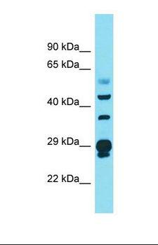 CRY Antibody - Western blot of Human Ovary Tumor. CRYL1 antibody dilution 1.0 ug/ml.  This image was taken for the unconjugated form of this product. Other forms have not been tested.