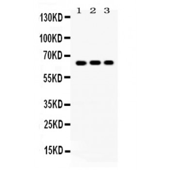 CRY1 Antibody - Cryptochrome I antibody Western blot. All lanes: Anti Cryptochrome I at 0.5 ug/ml. Lane 1: Rat Brain Tissue Lysate at 50 ug. Lane 2: Rat Testis Tissue Lysate at 50 ug. Lane 3: HELA Whole Cell Lysate at 40 ug. Predicted band size: 66 kD. Observed band size: 66 kD.