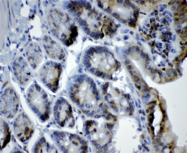 CRY1 Antibody - IHC analysis of CRY1 using anti-CRY1 antibody. CRY1 was detected in paraffin-embedded section of mouse intestine tissues. Heat mediated antigen retrieval was performed in citrate buffer (pH6, epitope retrieval solution) for 20 mins. The tissue section was blocked with 10% goat serum. The tissue section was then incubated with 1µg/ml rabbit anti-CRY1 Antibody overnight at 4°C. Biotinylated goat anti-rabbit IgG was used as secondary antibody and incubated for 30 minutes at 37°C. The tissue section was developed using Strepavidin-Biotin-Complex (SABC) with DAB as the chromogen.