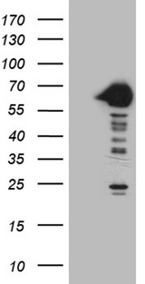 CRY1 Antibody - HEK293T cells were transfected with the pCMV6-ENTRY control. (Left lane) or pCMV6-ENTRY CRY1. (Right lane) cDNA for 48 hrs and lysed