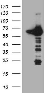 CRY1 Antibody - HEK293T cells were transfected with the pCMV6-ENTRY control. (Left lane) or pCMV6-ENTRY CRY1. (Right lane) cDNA for 48 hrs and lysed. Equivalent amounts of cell lysates. (5 ug per lane) were separated by SDS-PAGE and immunoblotted with anti-CRY1. (1:2000)