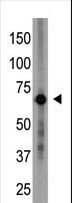 CRY1 Antibody - The anti-Cry1 N-term antibody is used in Western blot to detect Cry1 in placenta tissue lysate.