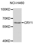 CRY1 Antibody - Western blot analysis of extracts of NCI-H460 cells, using CRY1 antibody at 1:1000 dilution. The secondary antibody used was an HRP Goat Anti-Rabbit IgG (H+L) at 1:10000 dilution. Lysates were loaded 25ug per lane and 3% nonfat dry milk in TBST was used for blocking. An ECL Kit was used for detection and the exposure time was 90s.