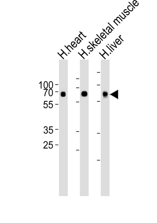 CRY2 Antibody - Western blot of lysates from human heart, skeletal muscle and liver tissue lysate (from left to right), using Cry2 Antibody(R579). Antibody was diluted at 1:1000 at each lane. A goat anti-rabbit IgG H&L (HRP) at 1:10000 dilution was used as the secondary antibody. Lysates at 35ug per lane.