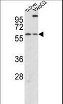 CRY2 Antibody - Western blot of hCry2-R579 in mouse liver tissue and HepG2 cell line lysates (35 ug/lane). CRY2 (arrow) was detected using the purified antibody.
