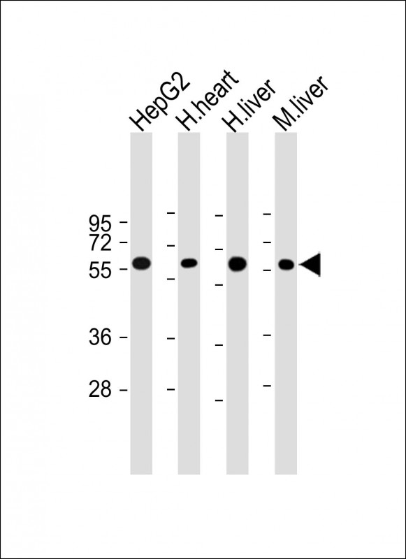 CRY2 Antibody - All lanes: Anti-Cry2 Antibody at 1:4000 dilution Lane 1: HepG2 whole cell lysate Lane 2: Human heart lysate Lane 3: Human liver lysate Lane 4: Mouse liver lysate Lysates/proteins at 20 µg per lane. Secondary Goat Anti-mouse IgG, (H+L), Peroxidase conjugated at 1/10000 dilution. Predicted band size: 67 kDa Blocking/Dilution buffer: 5% NFDM/TBST.