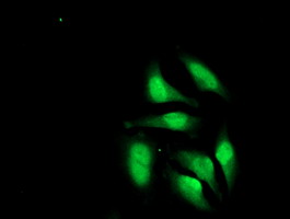 CRY2 Antibody - Immunofluorescent staining of HeLa cells using anti-CRY2 mouse monoclonal antibody.