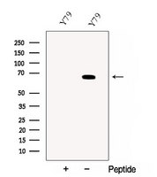 CRY2 Antibody - Western blot analysis of extracts of HuvEc cells using Cryptochrome 2 antibody. The lane on the left was treated with blocking peptide.