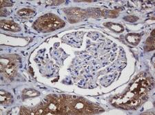 CRYAA / Alpha A Crystallin Antibody - IHC of paraffin-embedded Human Kidney tissue using anti-CRYAA mouse monoclonal antibody.