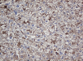 CRYAA / Alpha A Crystallin Antibody - IHC of paraffin-embedded Human liver tissue using anti-CRYAA mouse monoclonal antibody.