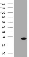 CRYAA / Alpha A Crystallin Antibody - HEK293T cells were transfected with the pCMV6-ENTRY control (Left lane) or pCMV6-ENTRY CRYAA (Right lane) cDNA for 48 hrs and lysed. Equivalent amounts of cell lysates (5 ug per lane) were separated by SDS-PAGE and immunoblotted with anti-CRYAA.
