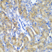 CRYAA / Alpha A Crystallin Antibody - Immunohistochemistry of paraffin-embedded rat kidney tissue.