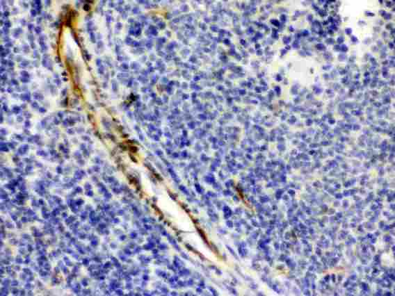 CRYAA / Alpha A Crystallin Antibody - Alpha A Crystallin was detected in paraffin-embedded sections of mouse spleen tissues using rabbit anti- Alpha A Crystallin Antigen Affinity purified polyclonal antibody