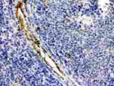 CRYAA / Alpha A Crystallin Antibody - Alpha A Crystallin was detected in paraffin-embedded sections of mouse spleen tissues using rabbit anti- Alpha A Crystallin Antigen Affinity purified polyclonal antibody