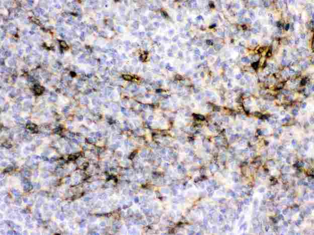 CRYAA / Alpha A Crystallin Antibody - Alpha A Crystallin was detected in paraffin-embedded sections of rat spleen tissues using rabbit anti- Alpha A Crystallin Antigen Affinity purified polyclonal antibody