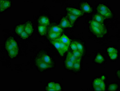 CRYAA / Alpha A Crystallin Antibody - Immunofluorescence staining of HepG2 cells at a dilution of 1:66, counter-stained with DAPI. The cells were fixed in 4% formaldehyde, permeabilized using 0.2% Triton X-100 and blocked in 10% normal Goat Serum. The cells were then incubated with the antibody overnight at 4 °C.The secondary antibody was Alexa Fluor 488-congugated AffiniPure Goat Anti-Rabbit IgG (H+L) .
