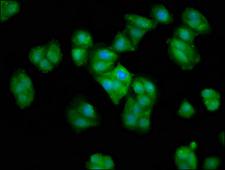CRYAA / Alpha A Crystallin Antibody - Immunofluorescence staining of HepG2 cells at a dilution of 1:66, counter-stained with DAPI. The cells were fixed in 4% formaldehyde, permeabilized using 0.2% Triton X-100 and blocked in 10% normal Goat Serum. The cells were then incubated with the antibody overnight at 4 °C.The secondary antibody was Alexa Fluor 488-congugated AffiniPure Goat Anti-Rabbit IgG (H+L) .