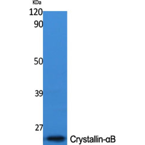 CRYAB / Alpha B Crystallin Antibody - Western blot of Crystallin-alphaB antibody