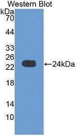 CRYAB / Alpha B Crystallin Antibody - Western blot of CRYAB / Alpha B Crystallin antibody.