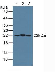 CRYAB / Alpha B Crystallin Antibody - Western Blot; Lane1: Mouse Brain Tissue; Lane2: Mouse Heart Tissue; Lane3: Porcine Brain Tissue.