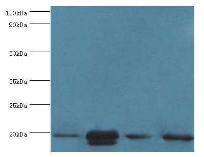 CRYAB / Alpha B Crystallin Antibody - Western blot. All lanes: Alpha-crystallin B chain antibody at 2 ug/ml. Lane 1: 293T whole cell lysate Lane 2: mouse eye tissue Lane 3: rat lung tissue Lane 3: rat heart tissue. Secondary antibody: goat polyclonal to rabbit at 1:10000 dilution.  This image was taken for the unconjugated form of this product. Other forms have not been tested.