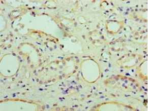 CRYAB / Alpha B Crystallin Antibody - Immunohistochemistry of paraffin-embedded human kidney using antibody at 1:100 dilution.  This image was taken for the unconjugated form of this product. Other forms have not been tested.