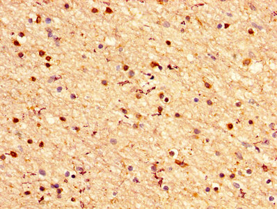 CRYAB / Alpha B Crystallin Antibody - IHC image of CRYAB Antibody diluted at 1:200 and staining in paraffin-embedded human brain tissue performed on a Leica BondTM system. After dewaxing and hydration, antigen retrieval was mediated by high pressure in a citrate buffer (pH 6.0). Section was blocked with 10% normal goat serum 30min at RT. Then primary antibody (1% BSA) was incubated at 4°C overnight. The primary is detected by a biotinylated secondary antibody and visualized using an HRP conjugated SP system.