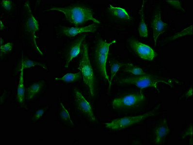 CRYAB / Alpha B Crystallin Antibody - Immunofluorescence staining of U251 cells with CRYAB Antibody at 1:66, counter-stained with DAPI. The cells were fixed in 4% formaldehyde, permeabilized using 0.2% Triton X-100 and blocked in 10% normal Goat Serum. The cells were then incubated with the antibody overnight at 4°C. The secondary antibody was Alexa Fluor 488-congugated AffiniPure Goat Anti-Rabbit IgG(H+L).