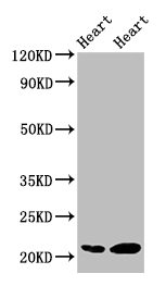 CRYAB / Alpha B Crystallin Antibody - Western blot All lanes: Alpha-crystallin B chain antibody at 2µg/ml Lane 1: 293T whole cell lysate Lane 2: Mouse eye tissue Lane 3: Rat lung tissue Lane 4: Rat heart tissue Secondary Goat polyclonal to rabbit IgG at 1/10000 dilution Predicted band size: 20 kDa Observed band size: 20 kDa