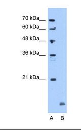 CRYAB / Alpha B Crystallin Antibody - Lane A: Marker. Lane B: Jurkat cell lysate. Antibody concentration: 5.0 ug/ml. Gel concentration: 12%.  This image was taken for the unconjugated form of this product. Other forms have not been tested.