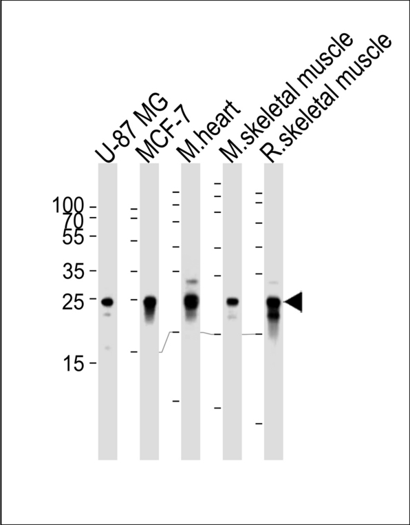 CRYAB / Alpha B Crystallin Antibody - Western blot of lysates from U-87 MG, MCF-7 cell line, mouse heart and skeletal muscle, rat skeletal muscle tissue lysates (from left to right) with CRYAB Antibody. Antibody was diluted at 1:1000 at each lane. A goat anti-mouse IgG H&L (HRP) at 1:3000 dilution was used as the secondary antibody. Lysates at 35 ug per lane.
