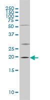 CRYAB / Alpha B Crystallin Antibody - CRYAB monoclonal antibody (M01), clone 1A10-1A4 Western Blot analysis of CRYAB expression in C32.