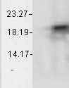 CRYAB / Alpha B Crystallin Antibody - Alpha B Crystallin (1A7. D5); AlphaA (L); AlphaB (R).  This image was taken for the unconjugated form of this product. Other forms have not been tested.