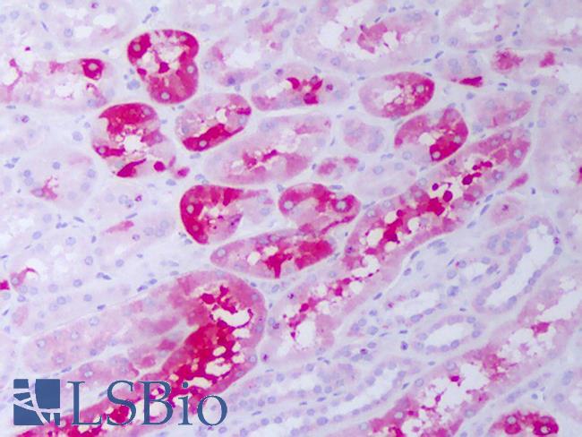 CRYAB / Alpha B Crystallin Antibody - Anti-CRYAB / Alpha B Crystallin antibody IHC of human kidney, tubules. Immunohistochemistry of formalin-fixed, paraffin-embedded tissue after heat-induced antigen retrieval. Antibody concentration 20 ug/ml.  This image was taken for the unconjugated form of this product. Other forms have not been tested.