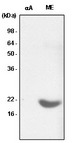 CRYAB / Alpha B Crystallin Antibody - Recombinant alpha-crystallin A (alphaA) and the extract of mouse eye (ME) were resolved by SDS-PAGE, transferred to PVDF membrane and probed with anti-human a-crystallin B antibody (1:1000). Proteins were visualized using a goat anti-mouse secondary antibody conjugated to HRP and an ECL detection system.