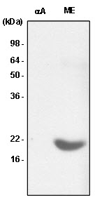 CRYAB / Alpha B Crystallin Antibody - Recombinant alpha-crystallin A (alphaA) and the extract of mouse eye (ME) were resolved by SDS-PAGE, transferred to PVDF membrane and probed with anti-human a-crystallin B antibody (1:1000). Proteins were visualized using a goat anti-mouse secondary antibody conjugated to HRP and an ECL detection system.
