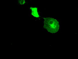 CRYAB / Alpha B Crystallin Antibody - Anti-CRYAB mouse monoclonal antibody immunofluorescent staining of COS7 cells transiently transfected by pCMV6-ENTRY CRYAB.