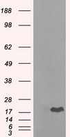 CRYAB / Alpha B Crystallin Antibody - HEK293T cells were transfected with the pCMV6-ENTRY control (Left lane) or pCMV6-ENTRY CRYAB (Right lane) cDNA for 48 hrs and lysed. Equivalent amounts of cell lysates (5 ug per lane) were separated by SDS-PAGE and immunoblotted with anti-CRYAB.