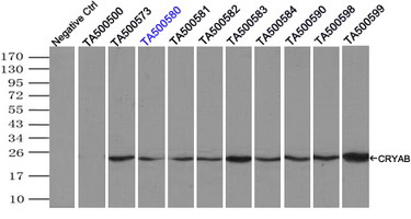 CRYAB / Alpha B Crystallin Antibody - Immunoprecipitation(IP) of CRYAB by using monoclonal anti-CRYAB antibodies (Negative control: IP without adding anti-CRYAB antibody.). For each experiment, 500ul of DDK tagged CRYAB overexpression lysates (at 1:5 dilution with HEK293T lysate), 2 ug of anti-CRYAB antibody and 20ul (0.1 mg) of goat anti-mouse conjugated magnetic beads were mixed and incubated overnight. After extensive wash to remove any non-specific binding, the immuno-precipitated products were analyzed with rabbit anti-DDK polyclonal antibody.