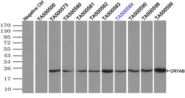 CRYAB / Alpha B Crystallin Antibody - Immunoprecipitation(IP) of CRYAB by using monoclonal anti-CRYAB antibodies (Negative control: IP without adding anti-CRYAB antibody.). For each experiment, 500ul of DDK tagged CRYAB overexpression lysates (at 1:5 dilution with HEK293T lysate), 2 ug of anti-CRYAB antibody and 20ul (0.1 mg) of goat anti-mouse conjugated magnetic beads were mixed and incubated overnight. After extensive wash to remove any non-specific binding, the immuno-precipitated products were analyzed with rabbit anti-DDK polyclonal antibody.