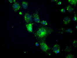 CRYAB / Alpha B Crystallin Antibody - Anti-CRYAB mouse monoclonal antibody  immunofluorescent staining of COS7 cells transiently transfected by pCMV6-ENTRY CRYAB.