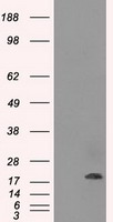CRYAB / Alpha B Crystallin Antibody - HEK293T cells were transfected with the pCMV6-ENTRY control (Left lane) or pCMV6-ENTRY CRYAB (Right lane) cDNA for 48 hrs and lysed. Equivalent amounts of cell lysates (5 ug per lane) were separated by SDS-PAGE and immunoblotted with anti-CRYAB.