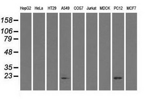 CRYAB / Alpha B Crystallin Antibody - Western blot of extracts (35 ug) from 9 different cell lines by using anti-CRYAB monoclonal antibody.