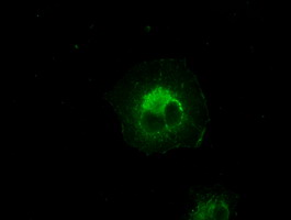 CRYAB / Alpha B Crystallin Antibody - Anti-CRYAB mouse monoclonal antibody  immunofluorescent staining of COS7 cells transiently transfected by pCMV6-ENTRY CRYAB.